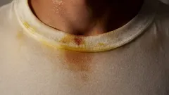 Valkoinen paita, jossa on kauluksessa kellertäviä ja ruskeita tahroja.
